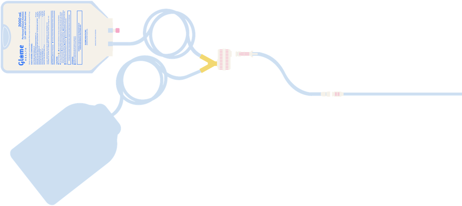 Sentry CAPD System assembly: bag set joined to transfer set via the rotary interconnect.